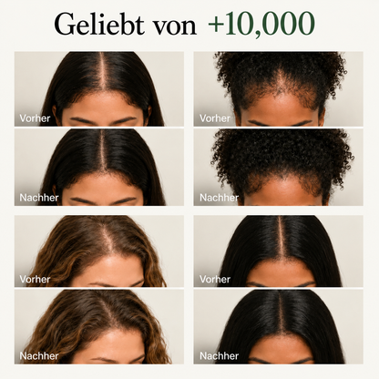 Trichéa™ - Revitalisierende Kopfhaut-Pflegebar