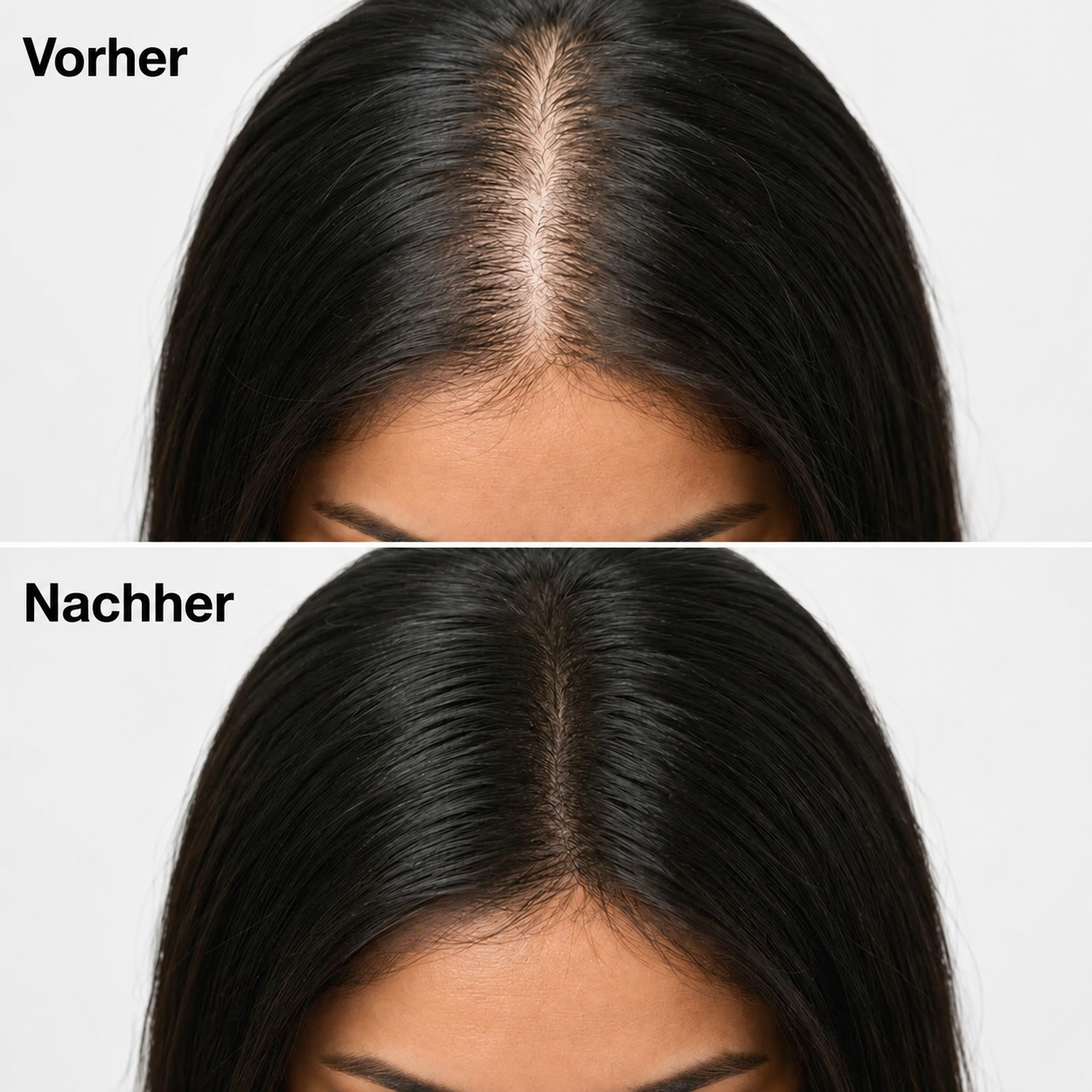 Trichéa™ - Revitalisierende Kopfhaut-Pflegebar