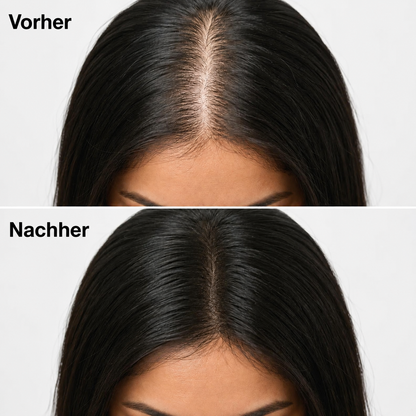 Trichéa™ - Revitalisierende Kopfhaut-Pflegebar
