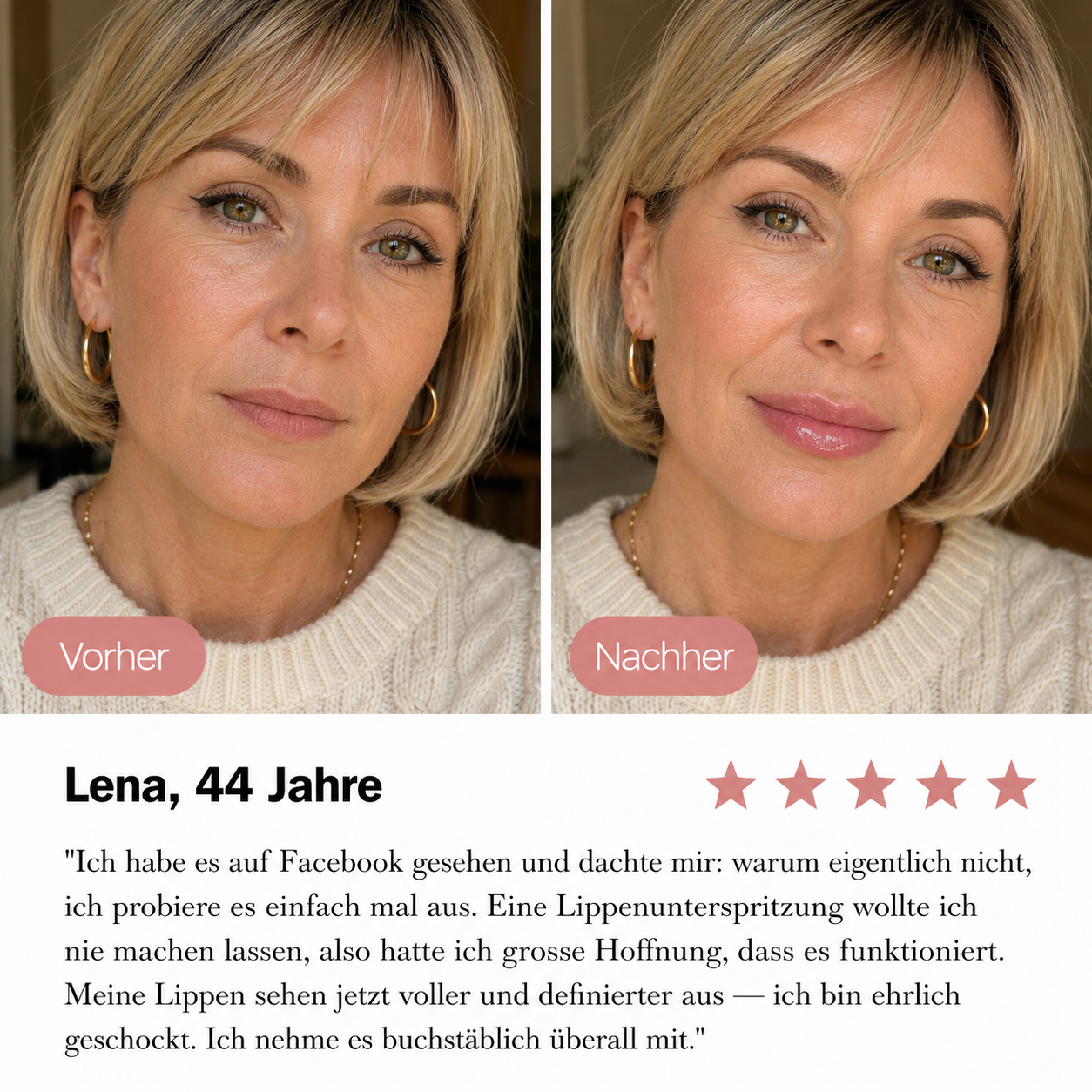 LIPTÉRA™ - Volumen-Lippenbooster